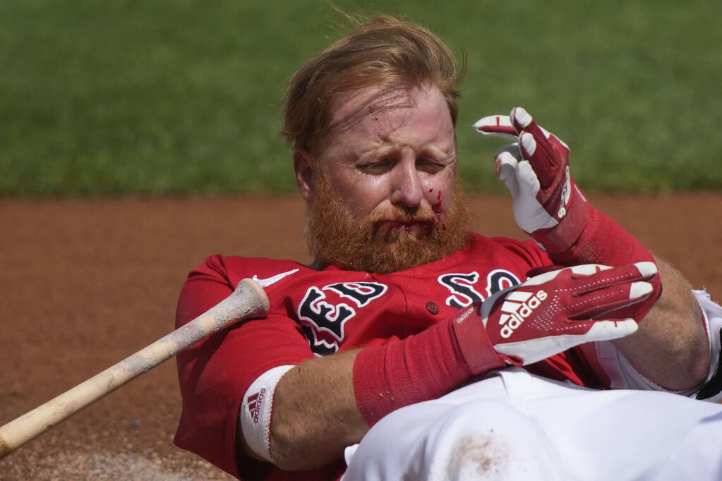 Red Sox Star Justin Turner Needs 16 Stitches In Face After Being