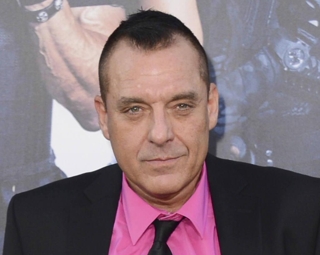 Tom Sizemore in critical condition after brain aneurysm