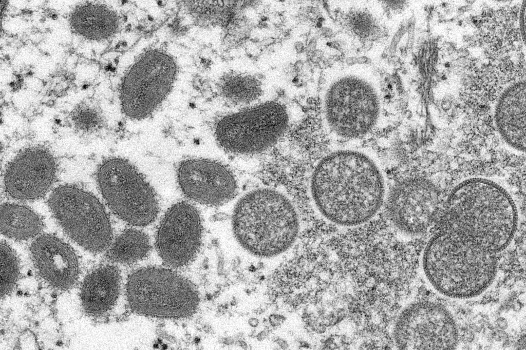 A 2003 electron microscope image made available by the Centers for Disease Control and Prevention shows mature, oval-shaped monkeypox virions, left, and spherical immature virions, right, obtained from a sample of human skin associated with the 2003 prairie dog outbreak. (Cynthia S. Goldsmith and Russell Regner / CDC via AP, File)