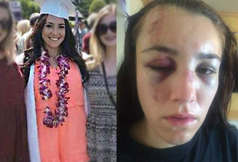 Gabbi Lemos shown at her graduation from Petaluma High School in 2015 (left) and two days after being arrested a few days later (right).