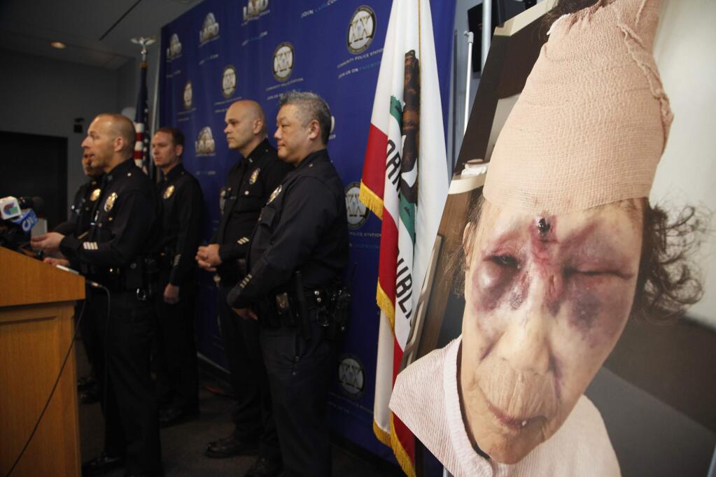 Los Angeles Police Capt. David Kowalski, far left, and other officers stand next to a photo of a crime victim Mi Reum Song during a news conference in Los Angeles, Monday, Feb. 12, 2018. The photo was taken by her granddaughter, Yujin Audrey Ko, and posted on Facebook after an attack Saturday in the Koreatown neighborhood. Police are looking for the man who attacked the woman, leaving her face bruised in what her family has called a random and unprovoked attack. (AP Photo/Damian Dovarganes)