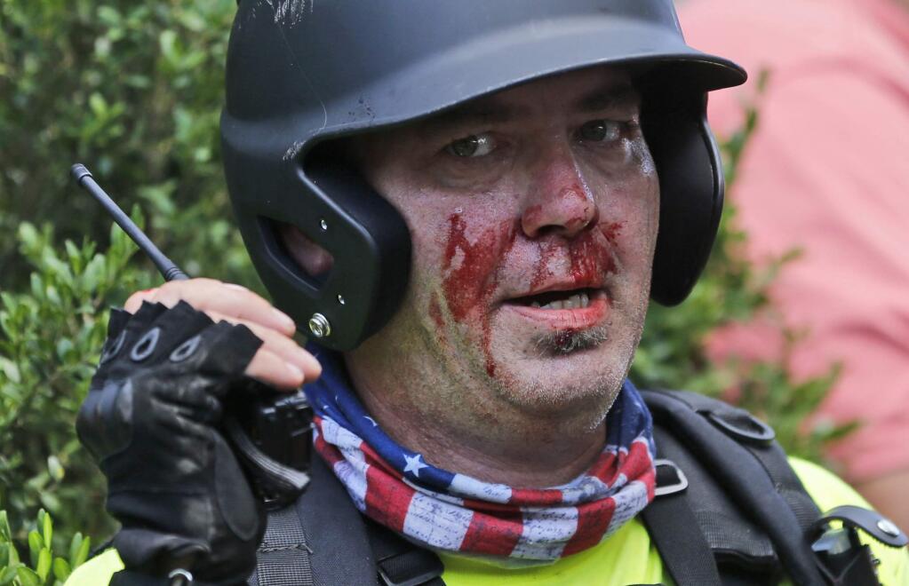 A white nationalist demonstrator, bloodied after a clash with a counter demonstrator, talks on the radio receiver at the entrance to Lee Park in Charlottesville, Va., Saturday, Aug. 12, 2017. Gov. Terry McAuliffe declared a state of emergency and police dressed in riot gear ordered people to disperse after chaotic violent clashes between white nationalists and counter protestors. (AP Photo/Steve Helber)