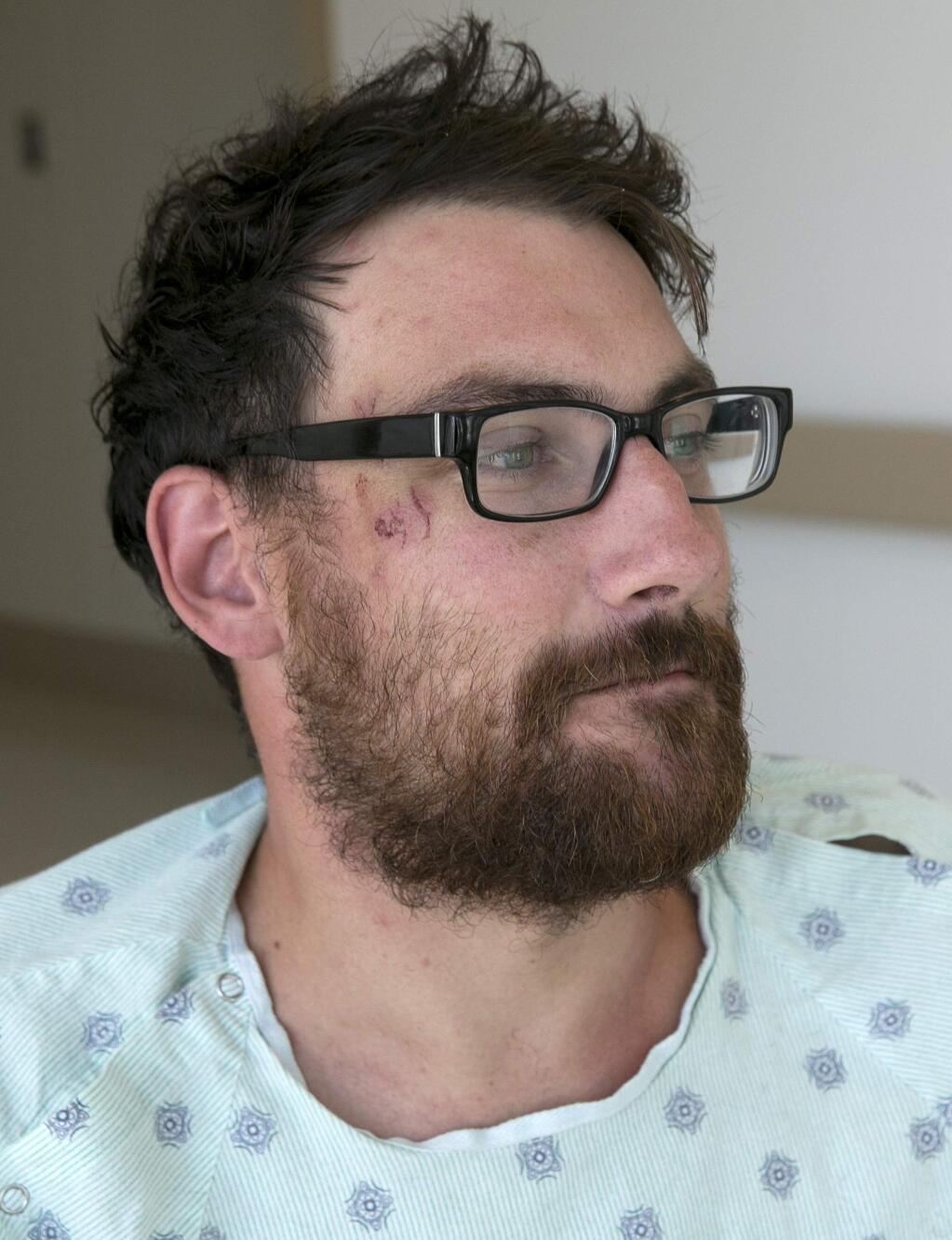 Mathias Steinhuber, of Innsbruck, Austria, who survived being struck by a lighting bolt, pauses while discussing the near-fatal event, Thursday, Aug. 24, 2017, in Sacramento, Calif. Steinhuber had been hiking the Pacific Crest Trail near Donner Summit Tuesday when he stopped to take a photo and was hit by the lighting. He was taken by helicopter to the the Tahoe Forest Hospital in Truckee, before being flown to the University of California, Davis Hospital Burn Center where he is listed in fair condition. He said he received the wound near his eye from falling on rocks after the lighting strike. (AP Photo/Rich Pedroncelli)