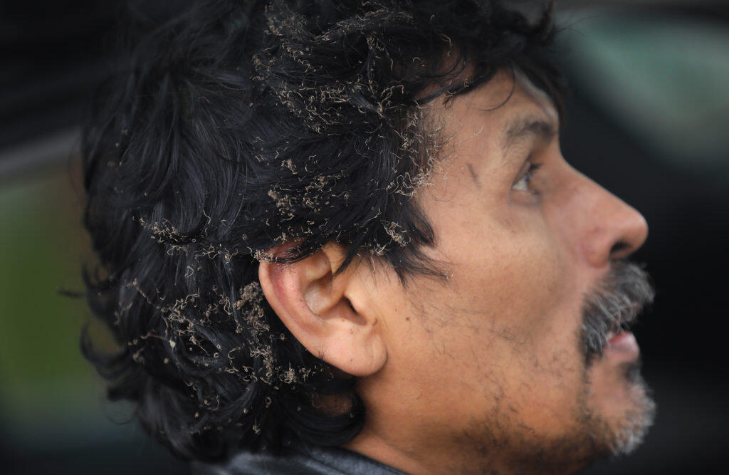 Jaime Toro singed his hair attempting to rescue animals from a burning home on Todd road in Santa Rosa, Tuesday, Jan. 15, 2019 but was pushed back by intense heat.  (Kent Porter / Press Democrat) 2019