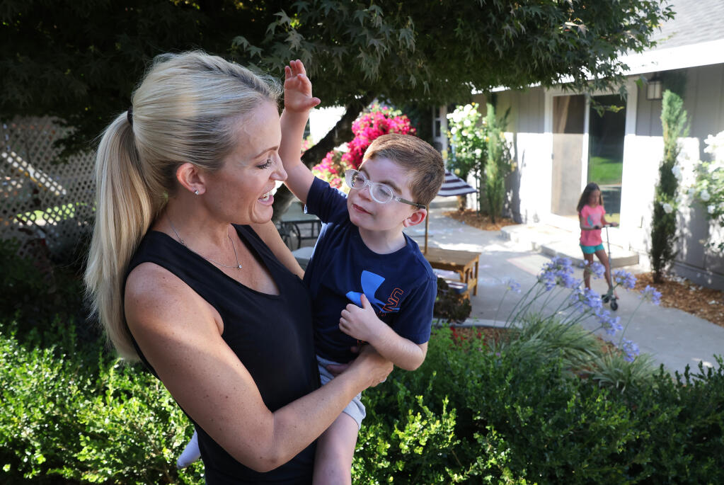 Melissa Staggs holds her 7-year-old son AJ at their home near Sebastopol on Friday, July 23, 2021.  AJ Staggs has Cornelia de Lange syndrome and requires special education.  (Christopher Chung/ The Press Democrat)