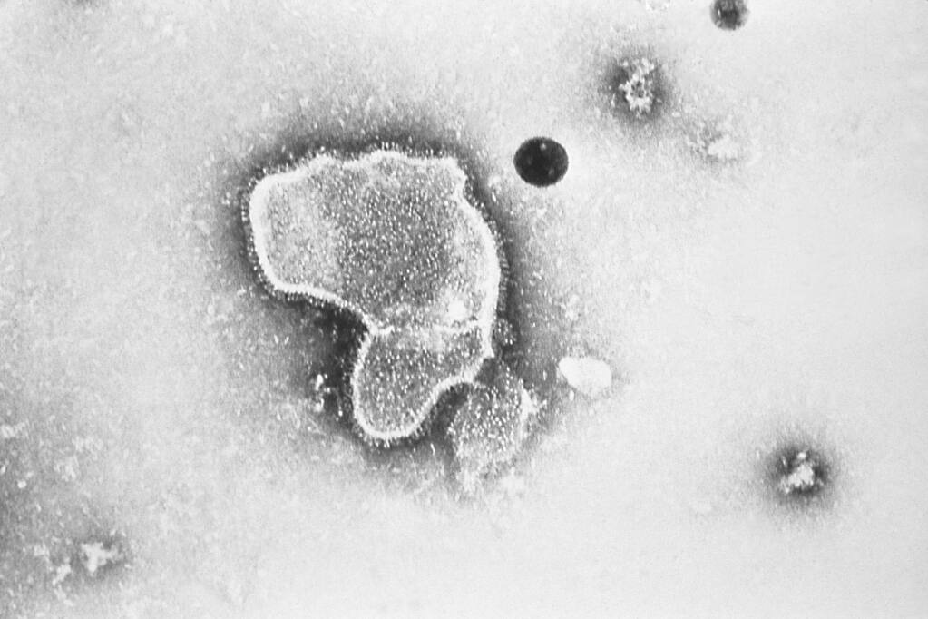 FILE - This 1981 photo provided by the Centers for Disease Control and Prevention (CDC) shows an electron micrograph of Respiratory Syncytial Virus, also known as RSV. (CDC via AP, File)