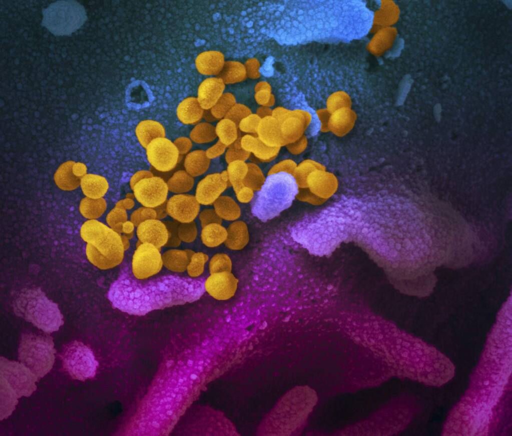 This undated electron microscope image made available by the U.S. National Institutes of Health in February 2020 shows the Novel Coronavirus SARS-CoV-2, yellow, emerging from the surface of cells, blue/pink, cultured in the lab. Also known as 2019-nCoV, the virus causes COVID-19. The sample was isolated from a patient in the U.S. (NIAID-RML via AP)