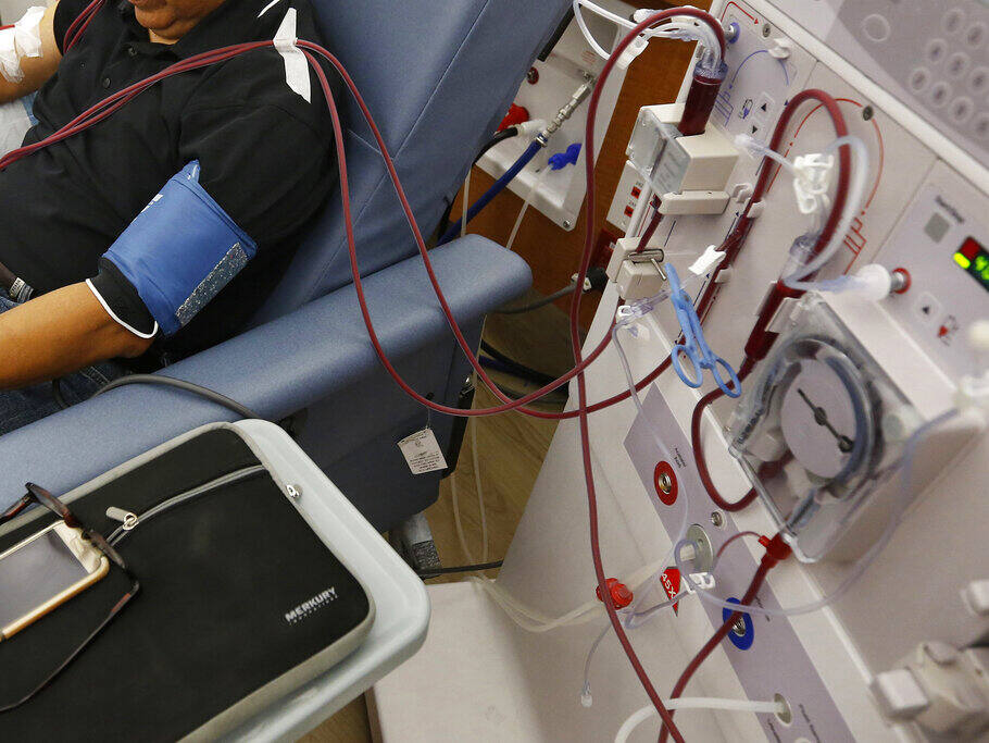 A patient undergoes dialysis at a Sacramento clinic. (RICH PEDRONCELLI / Associated Press, 2018)