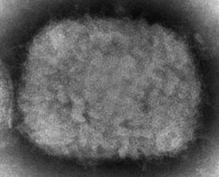 FILE - This 2003 electron microscope image made available by the Centers for Disease Control and Prevention shows a monkeypox virion, obtained from a sample associated with the 2003 prairie dog outbreak. (Cynthia S. Goldsmith, Russell Regner/CDC via AP, File)