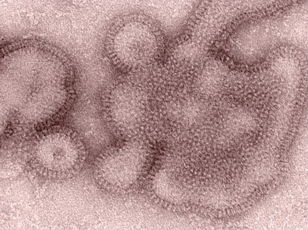 This 2011 image provided by the Centers for Disease Control and Prevention shows an H3N2 influenza virus - the same type of flu that's responsible for most flu illnesses this winter. (AP Photo/Centers for Disease Control and Prevention, Dr. Michael Shaw, Doug Jordan)