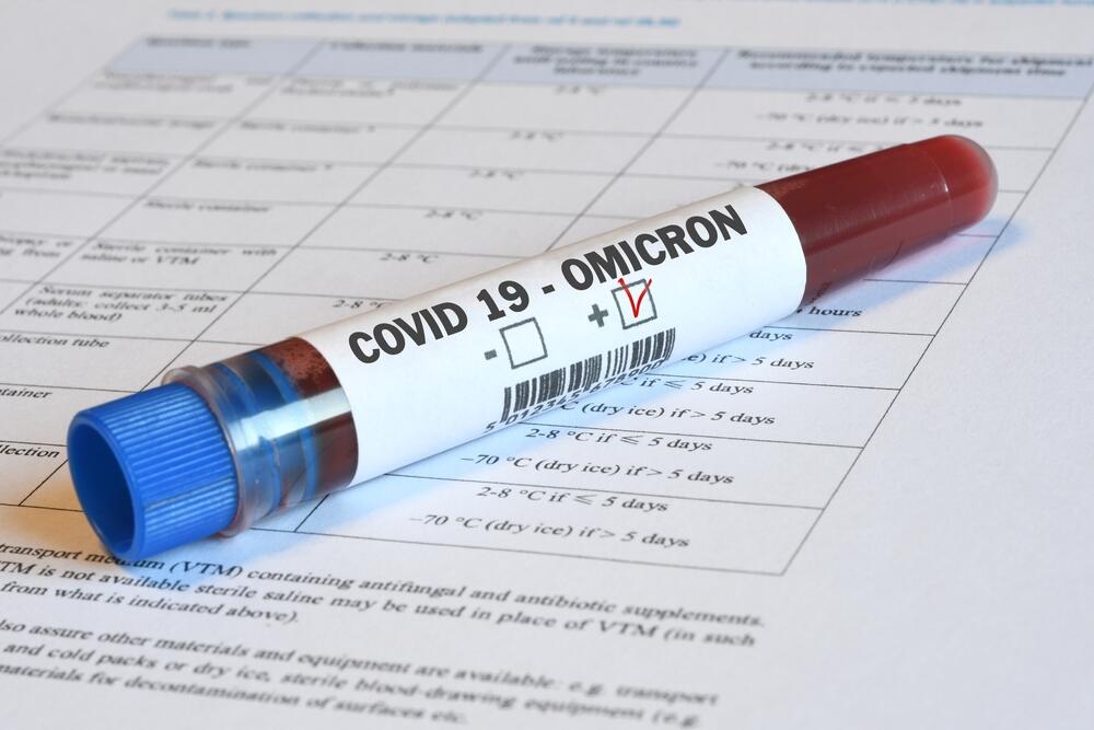 Blood tube for test detection of virus COVID-19 Omicron variant with positive result on papers document. (Dan74 / Shutterstock) 2021