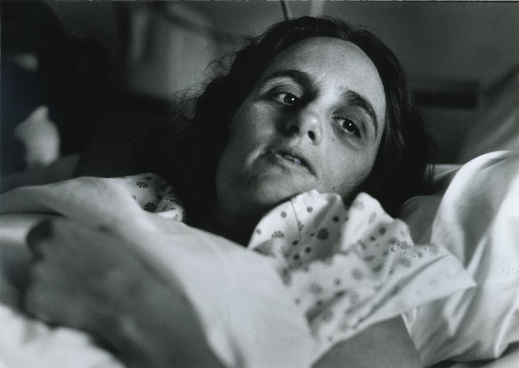 Judi Bari, leader in the North Coast environmental movement, grants an interview from her hospital bed in June 1990. She was severely injured after a bomb detonated in her car a month earlier. (The Press Democrat)