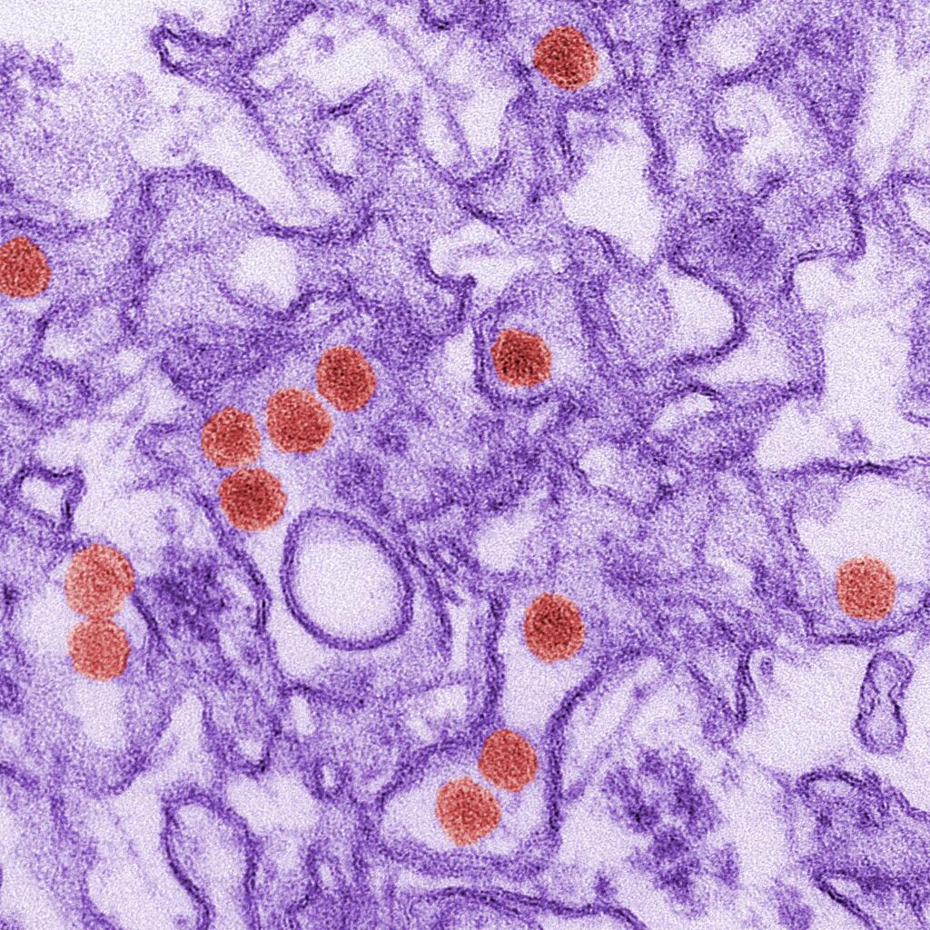 FILE - This 2016 digitally-colorized electron microscope image made available by the Centers for Disease Control and Prevention shows the Zika virus, in red, about 40 nanometers in diameter. On Friday, Aug. 26, 2016, U.S. health officials reported the first case of Zika spread through sex by a man who had no symptoms of the disease. In other cases of sexual transmission, the virus was spread by someone who at some point had symptoms. The Maryland man went to the Dominican Republic, where there is a Zika outbreak. He didn't get sick but his sex partner did and recovered. (Cynthia Goldsmith/CDC via AP)