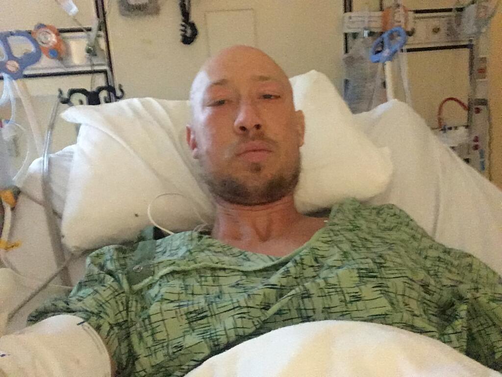 Eric Steinley had surgery on his leg at Santa Rosa Memorial Hospital in Santa Rosa, Calif. on Tuesday, Oct. 5, 2021 after he was bitten by a shark while surfing off Salmon Creek Beach over the weekend. (Courtesy of Eric Steinley)