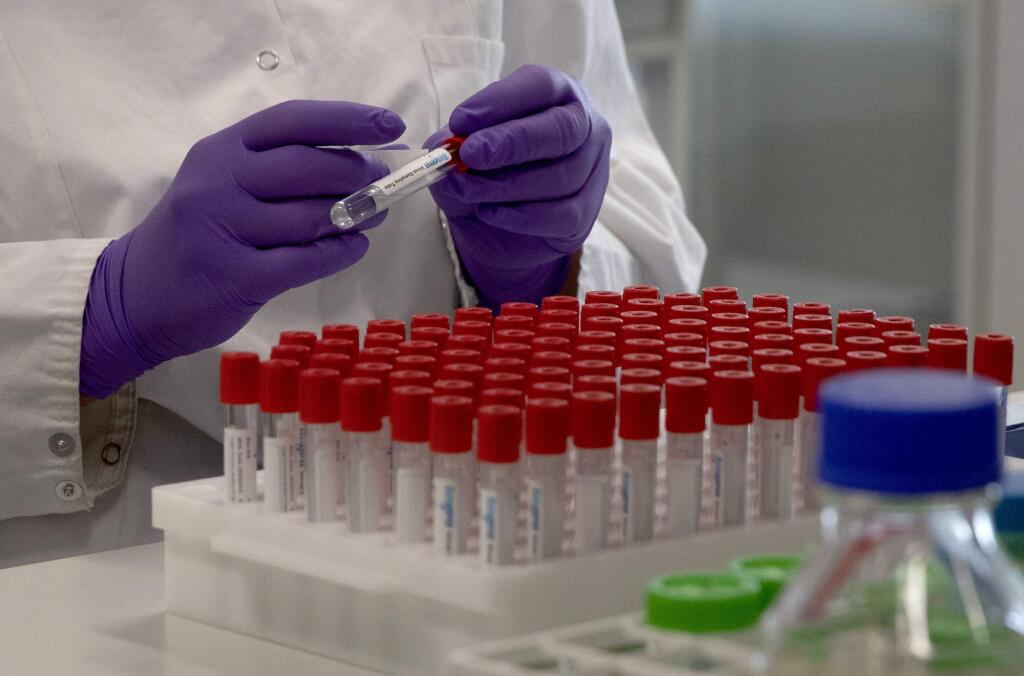 A lab technician puts a label on a test tube during research on coronavirus, COVID-19,  in Beerse, Belgium, Wednesday, June 17, 2020. After investigating its own COVID-19 testing lab for much of the year, the California Department of Public Health closed its case without issuing sanctions as the state released a long-overdue report Monday that downplayed widespread issues identified during inspections at the Valencia Branch Laboratory. (AP Photo/Virginia Mayo)