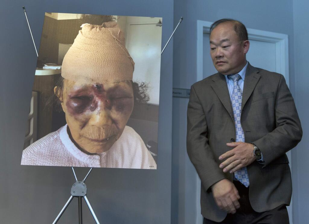Los Angeles Police Detective Heebae Cho stands next to a photo of a crime victim Mi Reum Song during a news conference in Los Angeles Monday, Feb. 12, 2018. The photo was taken by her granddaughter, Yujin Audrey Ko, and posted on Facebook after an attack Saturday, in the Koreatown neighborhood. Police are looking for the man who attacked the woman, leaving her face bruised in what her family has called a random and unprovoked attack. (AP Photo/Damian Dovarganes)