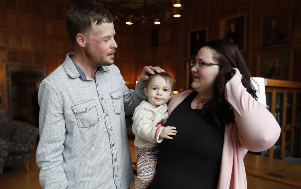Lilly Ross, right, holds her 17-month-old son Leonard as she talks with face transplant recipient Andy Sandness, left, after their first meeting at the Mayo Clinic, Friday, Oct. 27, 2017, in Rochester, Minn. Ross consented to the face transplant from her husband, despite her hesitation about someday seeing Rudy's face on a stranger. Eight months pregnant at the time, she said one reason to go forward was that she wanted the couple's child to one day understand what his father did to help others. (AP Photo/Charlie Neibergall)
