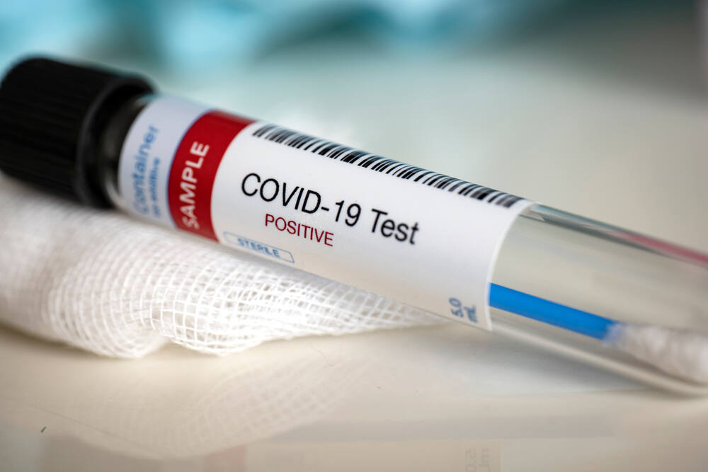 Testing for presence of coronavirus. Tube containing a swab sample that has tested positive for COVID-19. (Myriam B/Shutterstock)