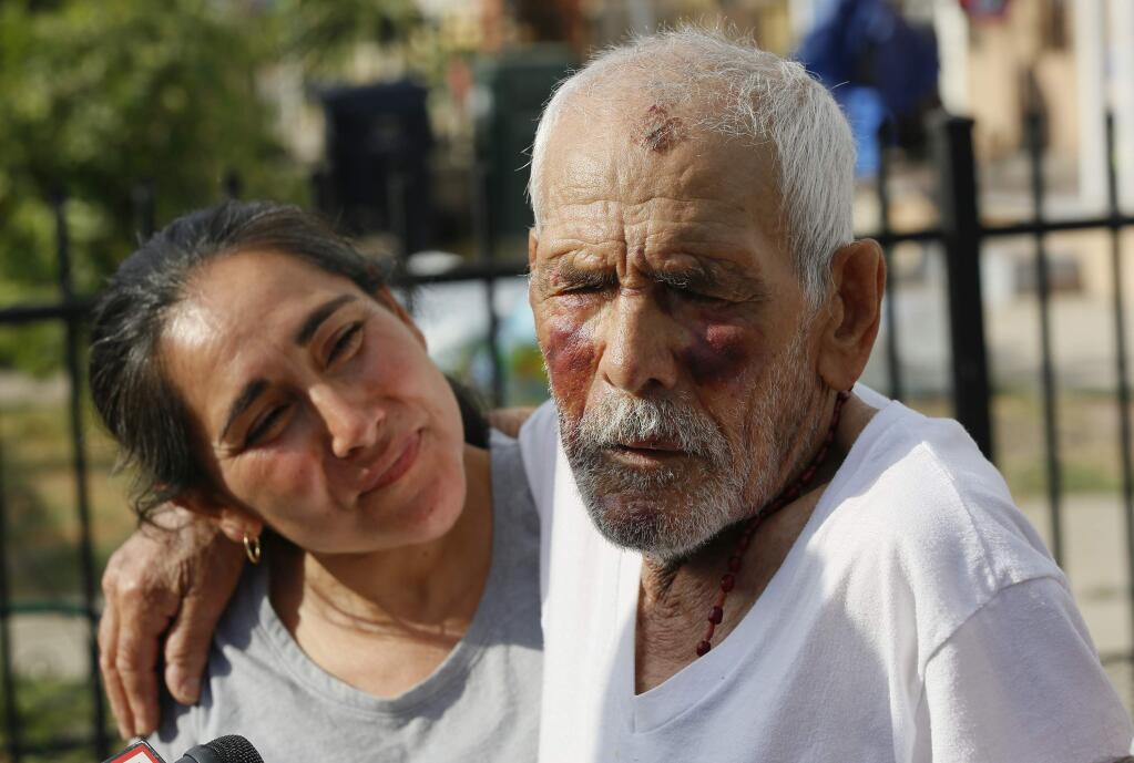 Aurelia Rodriguez, left, holds her father, Rodolfo Rodriguez as he thanks well-wishers for their help, as he talks to the media gathered outside his home in Los Angeles Wednesday, July 11, 2018. Rodolfo Rodriguez was out for a walk when he was beaten on the night of July 4 on a sidewalk in an unincorporated Willowbrook area, in Southern California. A witness said an assailant struck Rodriguez several times on the head with a brick and that multiple men reportedly also joined the attack. (AP Photo/Damian Dovarganes)