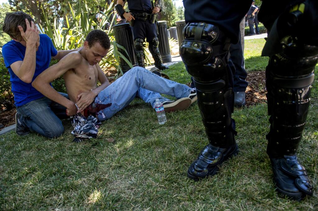 Sean Moore, 23, of Sacramento waits for medics with a friends after being stabbed by protesters at the State Capitol in Sacramento, Calif., on Sunday, June 26, 2016. Sacramento Fire Department spokesman Chris Harvey says a rally by KKK and other right-wing extremists groups turned violent Sunday when they were met by counterprotesters. (Renee C. Byer/The Sacramento Bee via AP) MAGS OUT; LOCAL TELEVISION OUT (KCRA3, KXTV10, KOVR13, KUVS19, KMAZ31, KTXL40); MANDATORY CREDIT