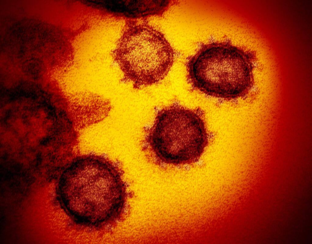 Do: Call your doctor if you're displaying symptoms of the illness. Fever, cough and shortness of breath are the most common symptoms of the coronavirus known as COVID-19. (NIAID-RML via AP)