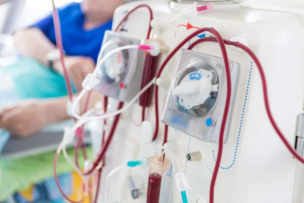Two state proposal threatened to make dialysis even more inconvient for patients.