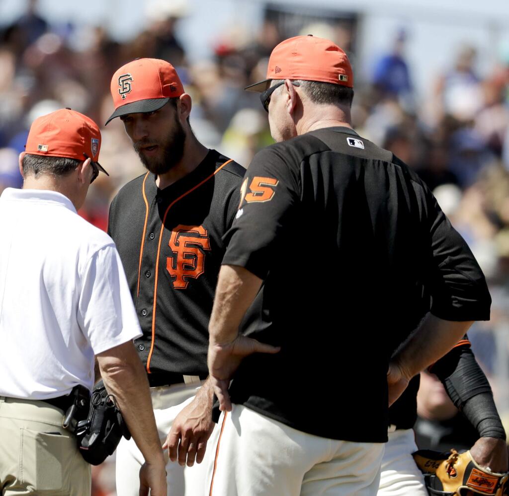 San Francisco Giants starting pitcher Madison Bumgarner, center, is looked over by manager Bruce Bochy, right, and a trainer after getting hit in the hand by a batted ball during the third inning against the Kansas City Royals in Scottsdale, Ariz., Friday, March 23, 2018. (AP Photo/Chris Carlson)