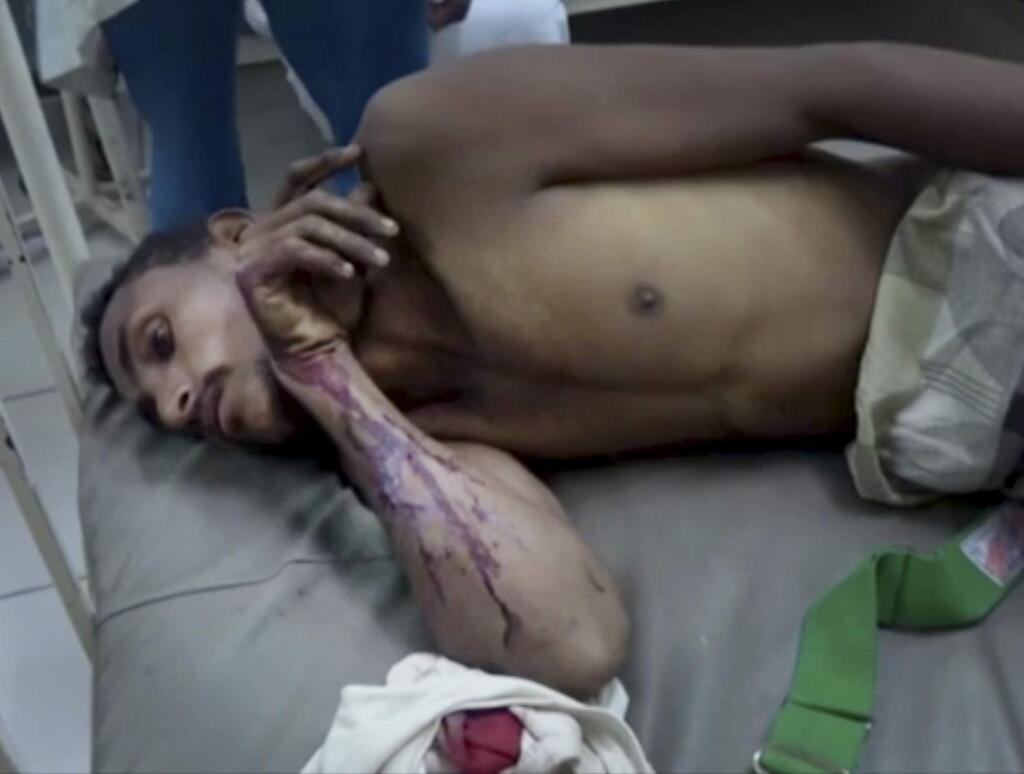 This Oct. 24, 2018 image made from Associated Press video shows, a man waiting to receive treatment on a hospital bed after a Saudi-led coalition strike that hit a fruit-and-vegetable market killing at least 21 civilians, in the town of Bayt el-Faqih near Hodeida, Yemen. Airstrikes by Saudi Arabia and its allies in Yemen are on a pace to kill more civilians in 2018 than last year despite US claims that the coalition is working to prevent such bloodshed, a database tracking violence shows. (AP Video via AP)