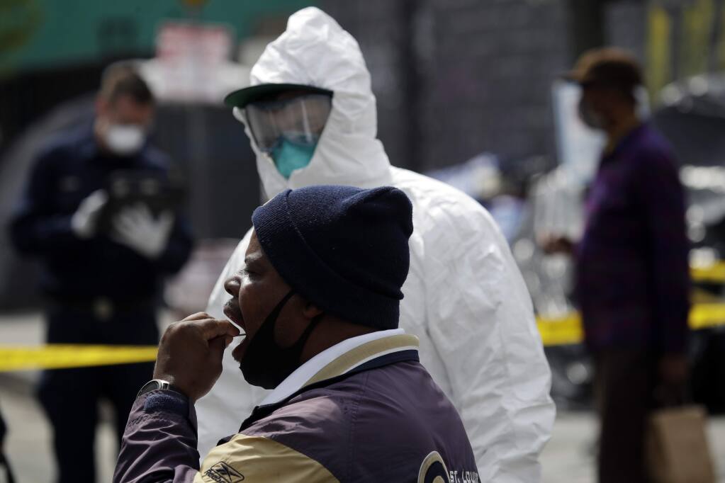 A man swabs his mouths while taking a COVID-19 test in the Skid Row district Monday, April 20, 2020, in Los Angeles. (AP Photo/Marcio Jose Sanchez)