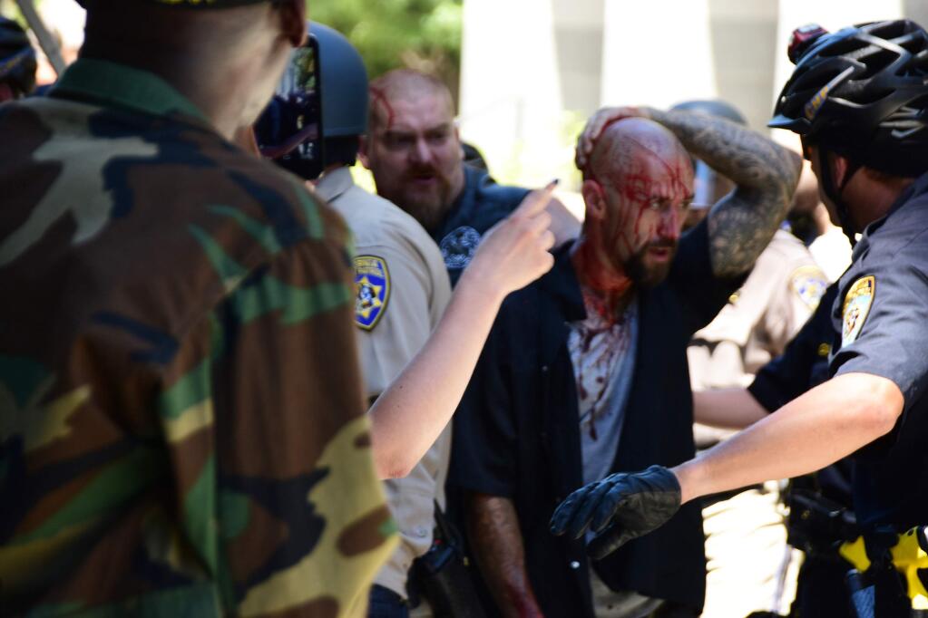 Police escort wounded man away from in front of the Cpitol in Scramento, Sunday, June 26, 2016, after members of right-wing extremists groups holding a rally outside the California state Capitol building clashed with counter-protesters, authorities said. Sacramento Police spokesman Matt McPhail said the Traditionalist Workers Party had scheduled and received a permit to protest at noon Sunday in front of the Capitol. McPhail said a group showed up to demonstrate against them. (AP Photo/Steven Styles)