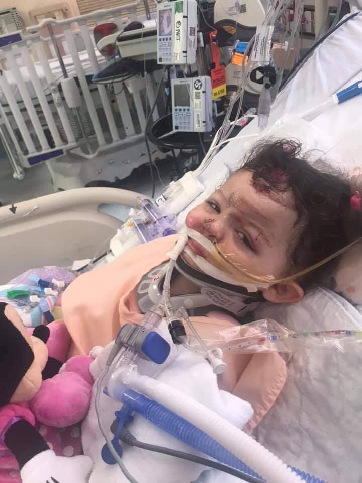 Saphira Howerton, 2, recovers in her hospital bed at Oakland Children's Hospital in July after suffering severe injuries in a hit-and-run collision in Santa Rosa. (APRIL HOWERTON/ FACEBOOK) ly. (APRIL HOWERTON/ FACEBOOK)