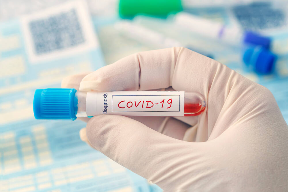 Travel leaders say they support all efforts to rid the world of the coronavirus pandemic – except for a mandate that would require airline passengers to present a negative COVID-19 test before flying.(diy13 / Shutterstock)