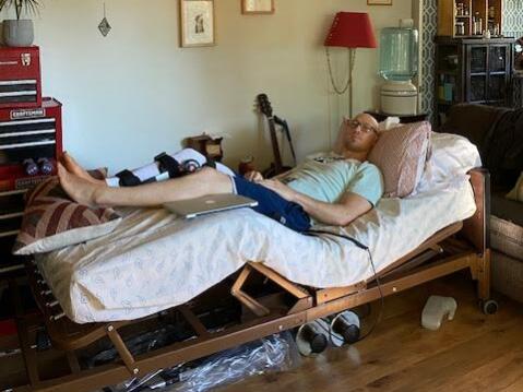 Eric Steinley recuperates in his Santa Rosa home after being bitten by a great white shark on Oct. 3, 2021. A month after the attack, he is still unable to walk, or put weight on his right foot. (Eric Steinley)