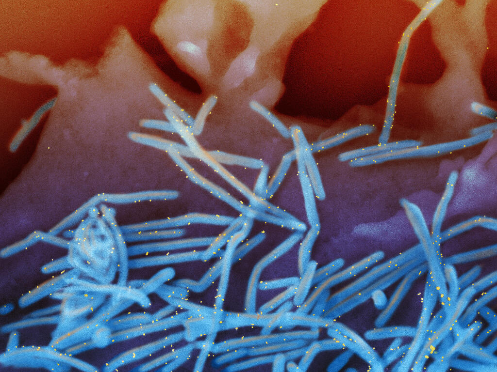FILE - This electron microscope image provided by the National Institutes of Health shows human respiratory syncytial virus (RSV) virions, colorized blue, and anti-RSV F protein/gold antibodies, colorized yellow, shedding from the surface of human lung cells. Advisers to the Food and Drug Administration on Thursday, May 18, 2023 debated a first-of-its-kind RSV vaccine to protect newborns by immunizing their moms late in pregnancy. (National Institute of Allergy and Infectious Diseases, NIH via AP)